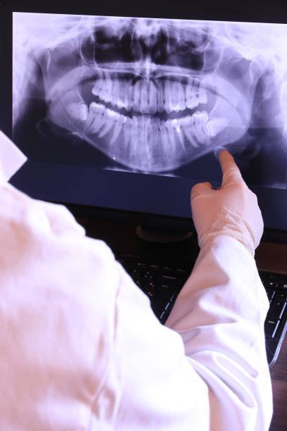Best Emergency Treatment for Dental Infections or Abscesses in Indian Shores, FL